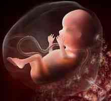 2 Trimestra trudnoće, ultrazvuk: transkripta