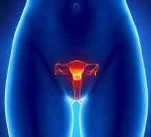Adenokarcinom maternice: faze, liječenje, prognozu