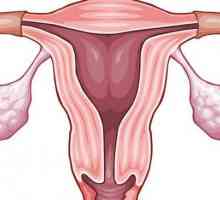 Adenomyoza maternice: znakovi i liječenje, recenzije