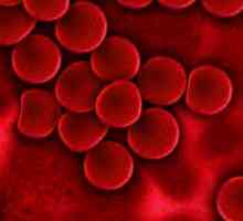 Krvna aglutinacija je ... Grupe krvi i reakcije aglutinacije