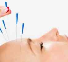 Akupunkturne točke na ljudskom tijelu