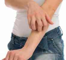 Alergije na nogama i rukama: uzroci, simptomi i karakteristike liječenja