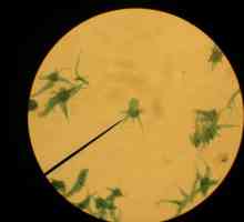 Ameba Proteus: klasa, stanište, fotografija. Kako se ameba proteus kreće?
