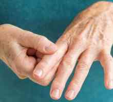 Analiza ACPC u reumatoidnom artritisu: norma, dekodiranje