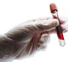 Što je krvni test za hemostazu?