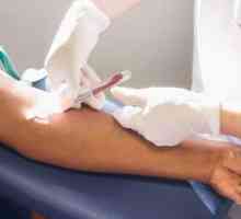 Krvni test za hepatitis