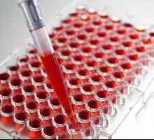 Krvni test za tuberkulozu: značajke, vrste i transkripcija