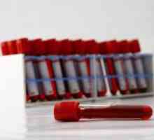 Test krvi kod djeteta: dekodiranje - možete li to sami napraviti?