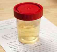 Analiza urina za sjetvu: koja pokazuje kako uzeti, dešifrirati