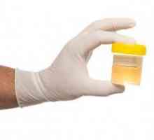 Analiza urina Nechiporenko: kako prikupiti biomaterijal za istraživanje?
