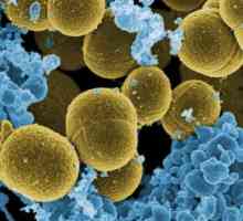 Staphylococcus analiza: kako se i gdje se predati