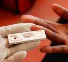 HIV test: vrijeme spremnosti, gdje i kada treba poduzeti