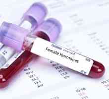 Analiza za ženske hormone: kada treba uzeti