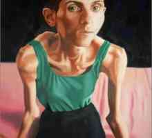 Anoreksija: fotografije prije i poslije. Muška anoreksija. Što je to bulimija i anoreksija?
