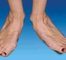 Artritis nogu: liječenje i uzroci izgleda