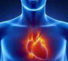 Asistola srca - što je to? Simptomi, uzroci, hitan tretman, liječenje