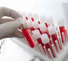 Ostaci dušika u biokemiji krvi