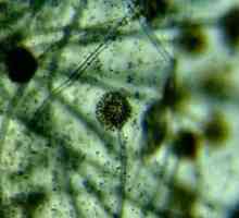 Bakterije i mikrobi pod mikroskopom (fotografija)