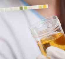 Biokemija urina: pravila prikupljanja i pokazatelji norme