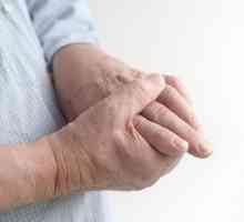 Bol u zglobovima u prstima: uzroci, liječenje
