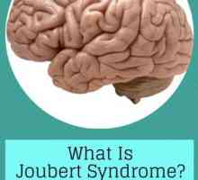 Bolest na razini genetike - Joubertov sindrom
