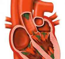 Bolest osjetljivog srca: simptomi i liječenje