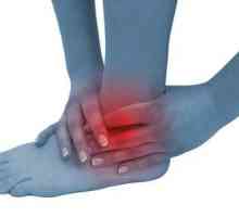 Bolest koja utječe na gležanj: artritis