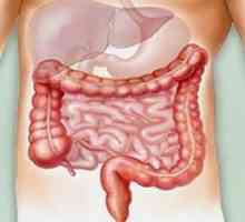 Bol u crijevima u donjem dijelu trbuha: simptomi i uzroci. Dijeta za bol u crijevu