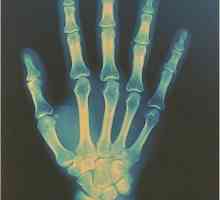 Bol ruke: uzroci, simptomi, liječenje