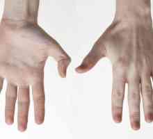 Dijelovi ruke: značajke anatomije