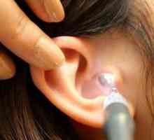 Čišćenje uha s vodikovim peroksidom kod kuće