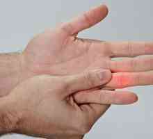 Što da radite ako nokautiš prst: simptome, prvu pomoć