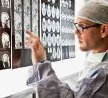 Što neurokirurzi liječe: opis medicinske specijalnosti