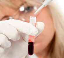 Što znači AFP test krvi? Alfa-fetoprotein: transkript