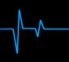 Što će pokazati EKG srca? Simptomi bolesti