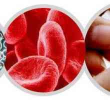 Što će klinički krvni test pokazati: dekodiranje, normalni indeksi i odstupanja