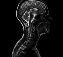Što prikazuje MRI vrata? MRI limfnih čvorova, posuda i mekih tkiva vrata