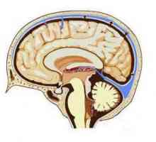 Što su moždane cisterne?