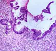 Что такое цитоплазма клетки. Особенности строения цитоплазмы