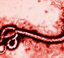 Što je Ebola i kako je virus prenesen ljudima?