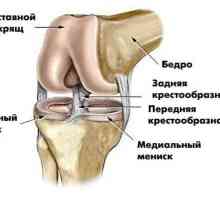 Što je MRI koljena, kako oni pokazuju MRI koljena?