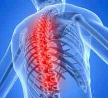 Što je osteochondrosis i kako se liječiti? Osteokondroza lumbalne regije. Uzroci osteohondroze
