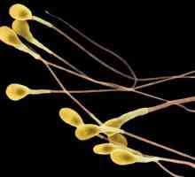 Što je sperma? Značajke muškog gamete