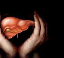 Ciroza jetre 4 stupnja: koliko žive? pogled