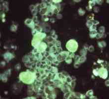 Citomegalovirus: što je to i koliko je opasna bolest?