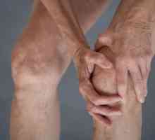 Deformiranje artroze koljena 2 stupnja: liječenje i uzroci