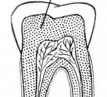 Dentin - što je ovo? Vrste, struktura, sastav i osobine liječenja