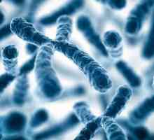 Denverova klasifikacija kromosoma kao osnova za kariotipizaciju