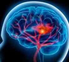 Dijeta za moždani udar: izbornici i preporuke liječnika