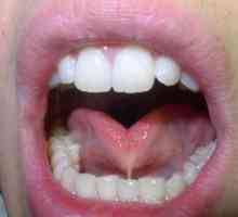 Dno usne šupljine (anatomija). Usmena šupljina: struktura, fiziologija